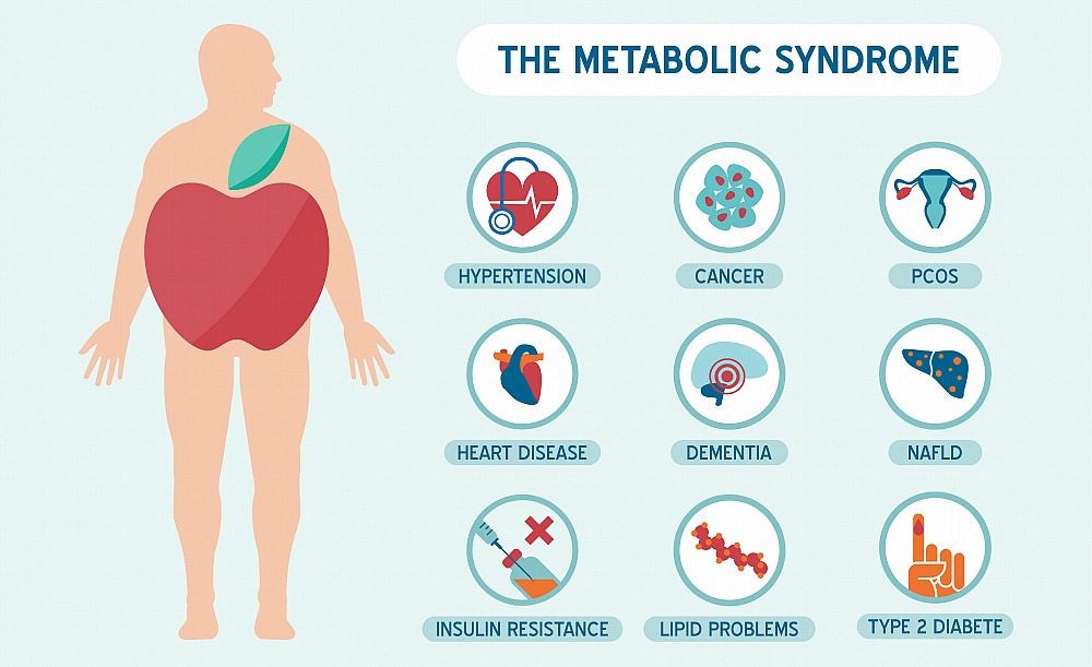 Metabolic syndrome: Why food and movement beats drugs